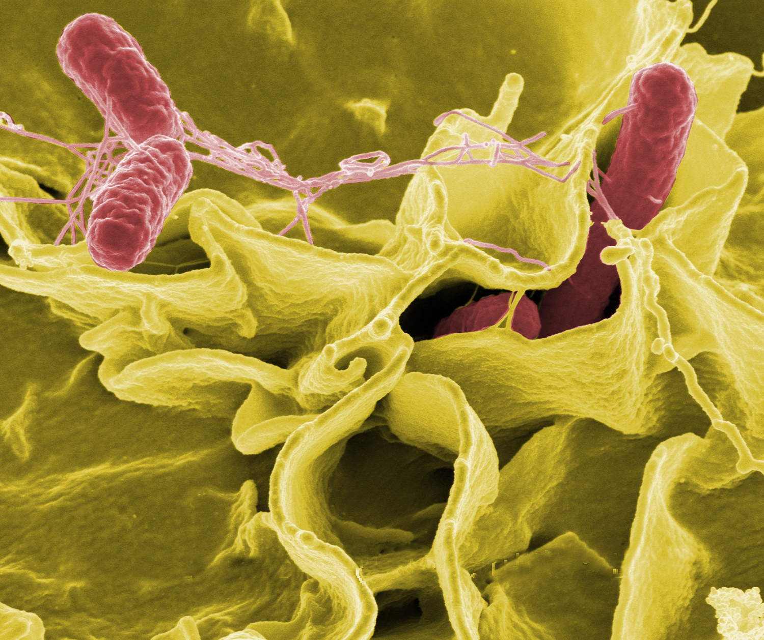 bacteria-1913206-3